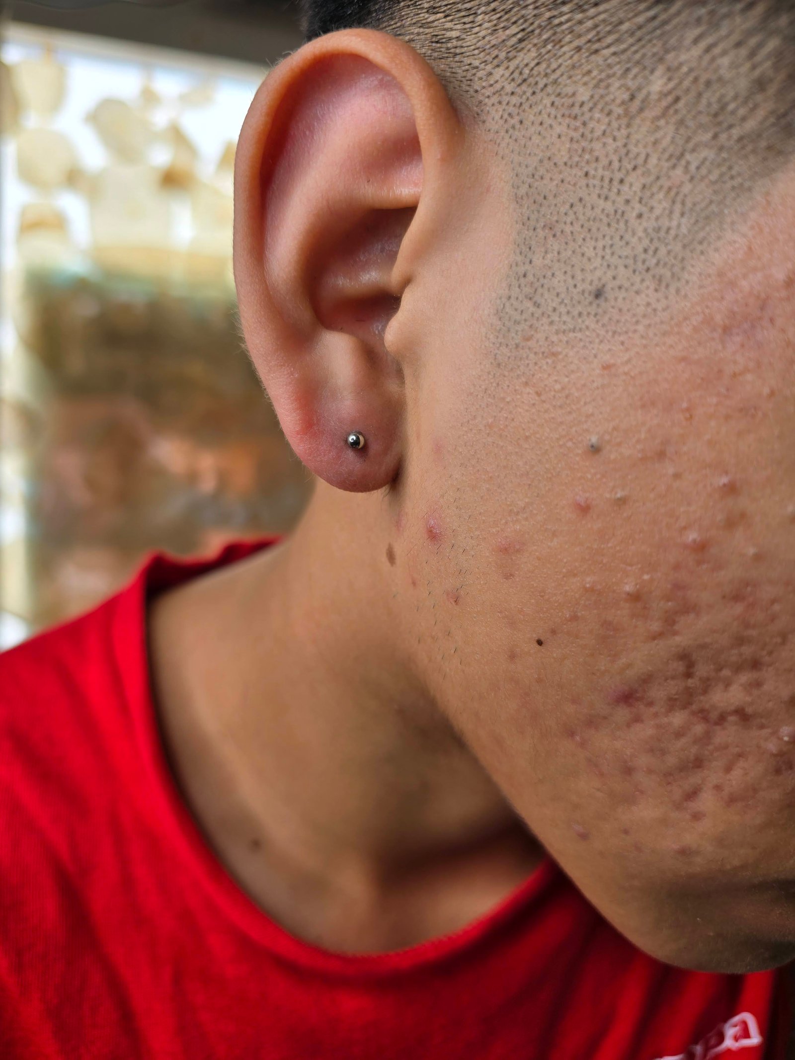 Piercing & microdermal